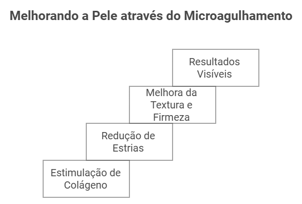 Benefícios do Microagulhamento para Estrias