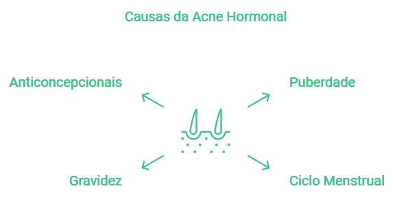 Causas da Acne Hormonal