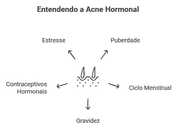 Entenda a Acne Hormonal