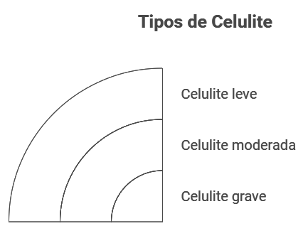 Tipos de Celulite