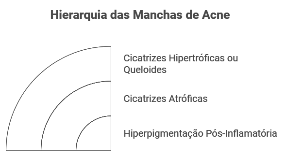 Tipos de Manchas e Cicatrizes Pós-Acne