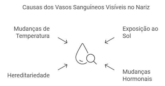 Causas comuns dos vasinhos no nariz