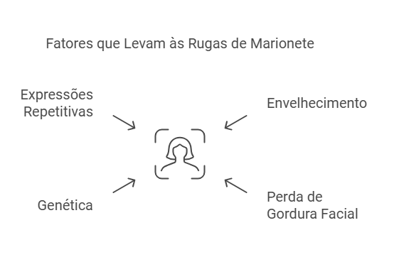 O que são Rugas de Marionete