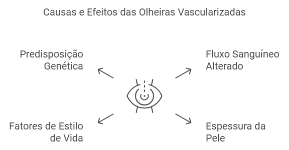 O que são olheiras vascularizadas Descubra os sinais escondidos no seu olhar