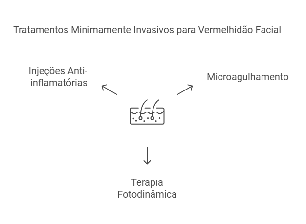 Opções minimamente invasivas para tratar manchas vermelhas no rosto