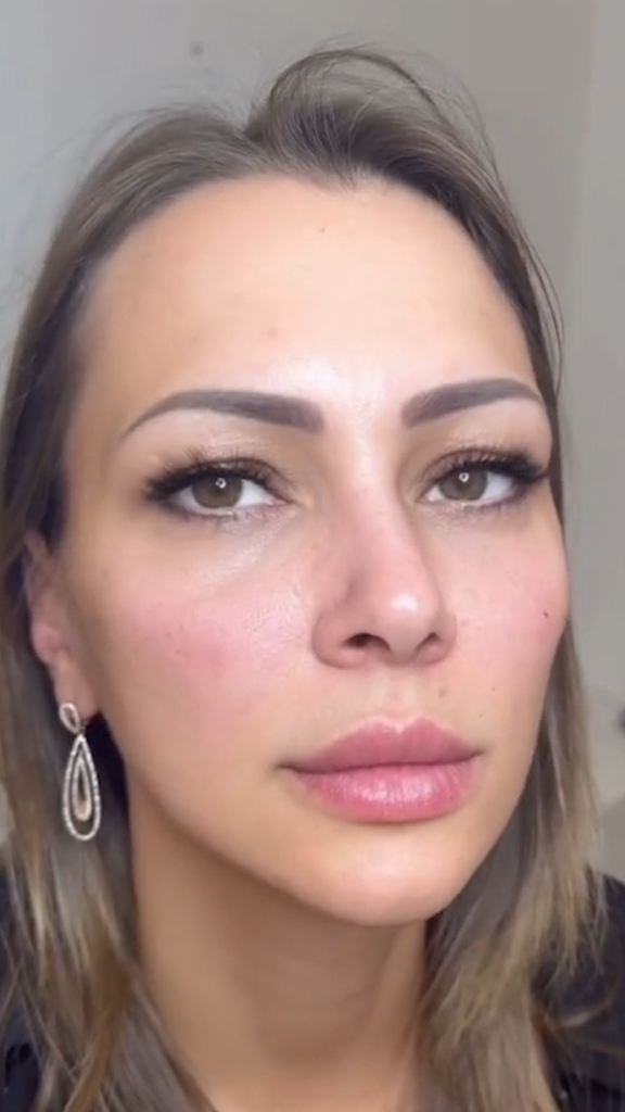 Depois - Bigode Chinês - Est&eacute;tica Batel Curitiba