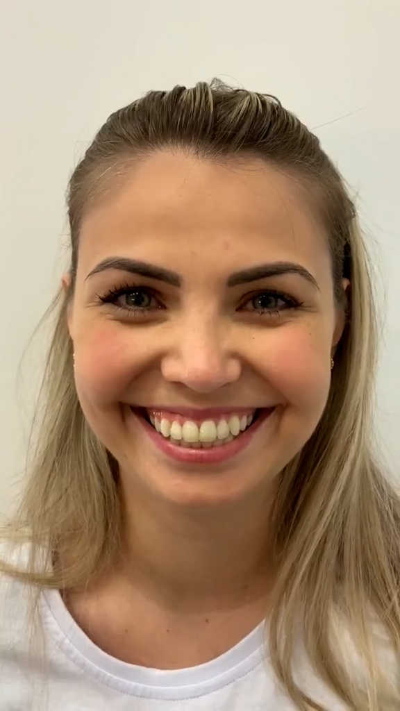 Antes - Harmonização Facial - Est&eacute;tica Batel Curitiba