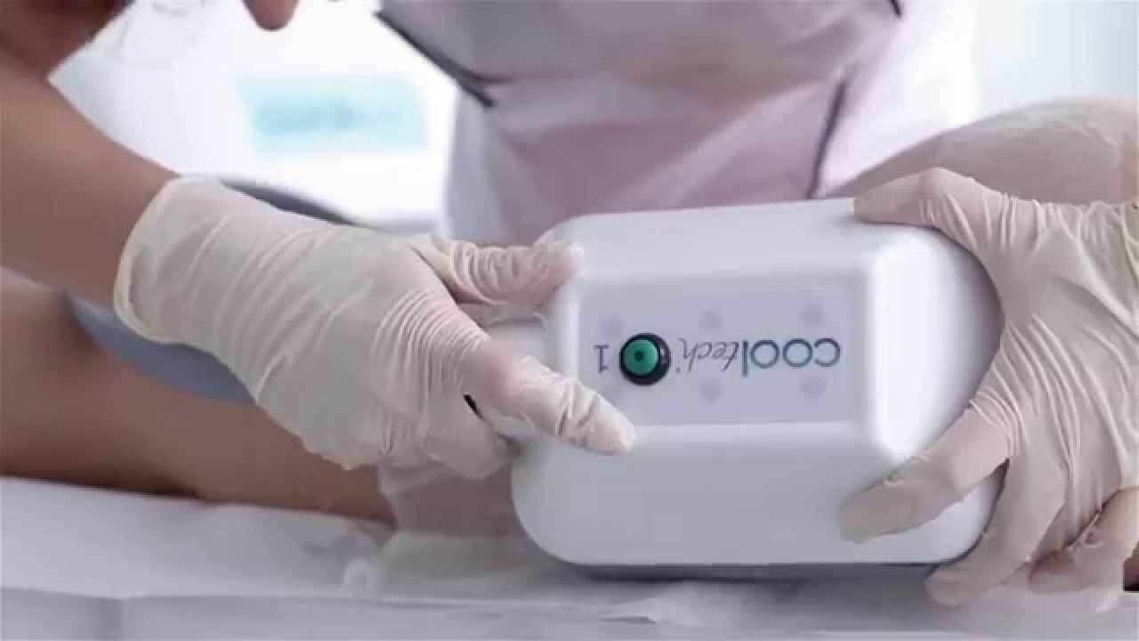 CRIOLIPÓLISE COOL-TECH — Após esse passo, iniciar o acoplamento na paciente: posicionar a manopla no desenho realizado e clicar no botão local...