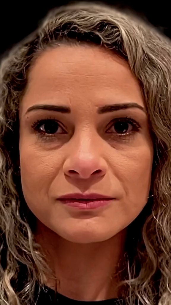 Antes - Rejuvenescimento - Est&eacute;tica Batel Curitiba