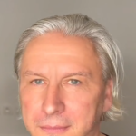 Resultado de toxina botulínica masculina
